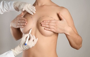 Μέθοδοι αύξησης του μαστού με χειρουργική επέμβαση